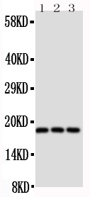 Anti-CD90/Thy1 antibody, PA1515-1, Western blotting Lane 1: Rat Brain Tissue Lysate Lane 2: Rat Liver Tissue Lysate Lane 3: Rat Thymus Tissue Lysate