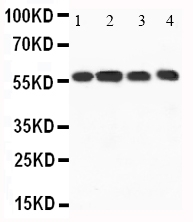 Anti-CaMKK antibody, PA1520, Western blotting Lane 1: Rat Brain Tissue Lysate Lane 2: Rat Brain Tissue Lysate Lane 3: Mouse Brain Tissue Lysate Lane 4: Mouse Brain Tissue Lysate