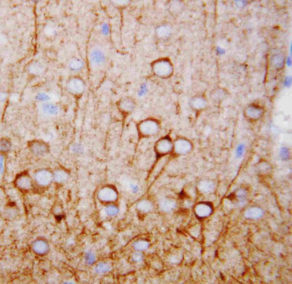 Anti-CaMKK antibody, PA1520, IHC(P) IHC(P): Rat Brain Tissue