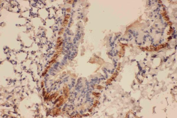 Anti-Canstatin antibody, PA1521, IHC(P) IHC(P): Mouse Lung Tissue