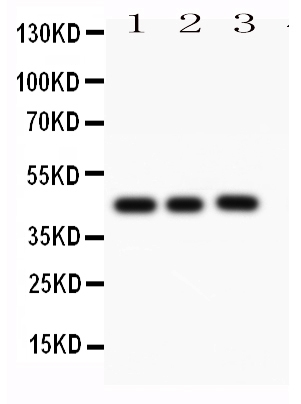 Anti-Caspase-1(P10) antibody, PA1522, Western blotting All lanes: Anti CASP1(P10) (PA1522) at 0.5ug/ml Lane 1: MCF-7 Whole Cell Lysate at 40ug Lane 2: HELA Whole Cell Lysate at 40ug Lane 3: SW620 Whole Cell Lysate at 40ug Predicted bind size: 45KD Observed bind size: 45KD