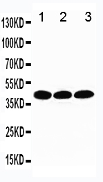 Anti-TBP antibody, PA1534, Western blotting Lane 1: MCF-7 Cell Lysate Lane 2: MM231 Cell Lysate Lane 3: MM231 Cell Lysate