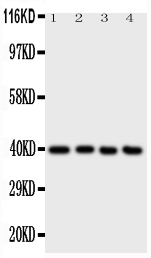 Anti-ATF4 antibody, PA1537, Western blotting All lanes: Anti ATF4 (PA1537) at 0.5ug/ml