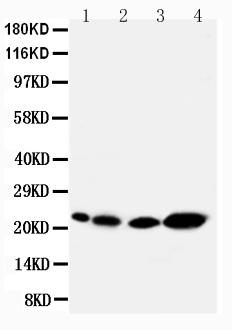 Anti-Caveolin-2 antibody, PA1540, Western blotting Lane 1: Rat Heart Tissue Lysate Lane 2: Rat lung Tissue Lysate Lane 3: HELA Cell Lysate Lane 4: A431 Cell Lysate