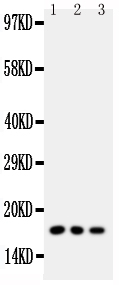 Anti-Caveolin-2 antibody, PA1540, Western blotting All lanes: Anti Caveolin-2 (PA1540) at 0.5ug/ml