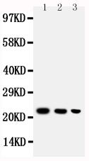 Anti-BAFF antibody, PA1541, Western blotting Lane 1: Recombinant Human BAFF Protein 10ng Lane 2: Recombinant Human BAFF Protein 5ng Lane 3: Recombinant Human BAFF Protein 2.5ng