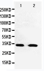 Anti-Cdk5 antibody, PA1548, Western blotting Lane 1: HELA Cell Lysate Lane 2: JURKAT Cell Lysate