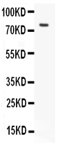 Anti-hCG receptor antibody, PA1552, Western blotting All lanes: Anti hCG receptor (PA1552) at 0.5ug/ml WB: MCF-7 Whole Cell Lysate at 40ug Predicted bind size: 78KD Observed bind size: 78KD