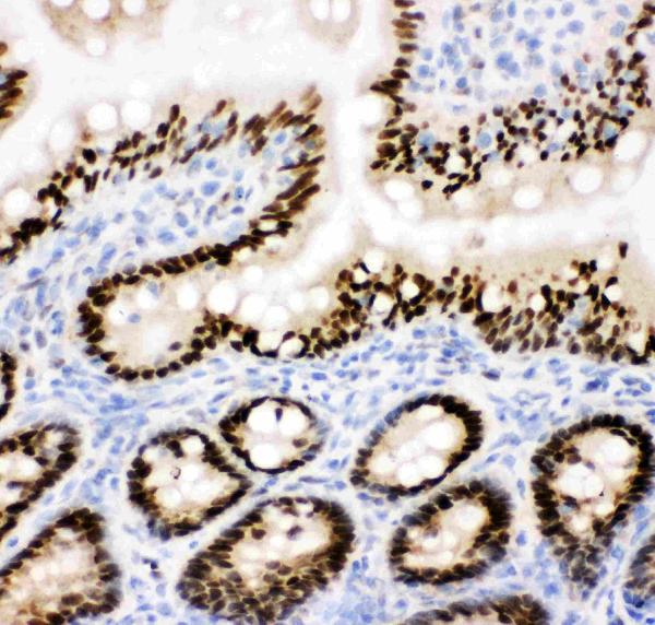 IHC analysis of CTBP2 using anti-CTBP2 antibody (PA1554). CTBP2 was detected in frozen section of rat intestine tissue. The tissue section was blocked with 10% goat serum. The tissue section was then incubated with 1μg/ml rabbit anti-CTBP2 Antibody (PA1554) overnight at 4°C. Biotinylated goat anti-rabbit IgG was used as secondary antibody and incubated for 30 minutes at 37°C. The tissue section was developed using Strepavidin-Biotin-Complex (SABC)(Catalog # SA1022) with DAB as the chromogen.