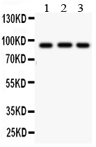 Anti-Cullin 1 antibody, PA1557, Western blotting All lanes: Anti Cullin 1 (PA1557) at 0.5ug/ml Lane 1: MM453 Whole Cell Lysate at 40ug Lane 2: HT1080 Whole Cell Lysate at 40ug Lane 3: SMMC Whole Cell Lysate at 40ug Predicted bind size: 90 KD Observed bind size: 90 KD