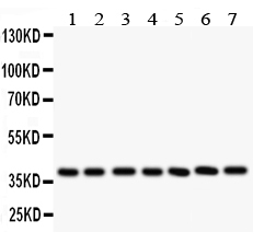 Anti-LIF antibody, PA1562, Western blotting All lanes: Anti LIF (PA1562) at 0.5ug/ml Lane 1: Rat Intestine Tissue Lysate at 50ug Lane 2: Rat Brain Tissue Lysate at 50ug Lane 3: Rat Spleen Tissue Lysate at 50ug Lane 4: Rat Thymus Tissue Lysate at 50ug Lane 5: Mouse Brain Tissue Lysate at 50ug Lane 6: Mouse Kidney Tissue Lysate at 50ug Lane 7: Mouse Liver Tissue Lysate at 50ug Predicted bind size: 22KD Observed bind size: 40KD