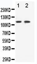 Anti-Eph receptor B3 antibody, PA1569, Western blotting Lane 1: HELA Cell Lysate Lane 2: A549 Cell Lysate