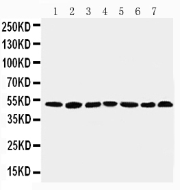 Anti-CtBP1 antibody, PA1570, Western blotting Lane 1: Rat Brain Tissue Lysate Lane 2: Rat Testis Tissue Lysate Lane 3: Rat Ovary Tissue Lysate Lane 4: U87 Cell Lysate Lane 5: SW620 Cell Lysate Lane 6: HT1080 Cell Lysate Lane 7: COLO32 Cell Lysate