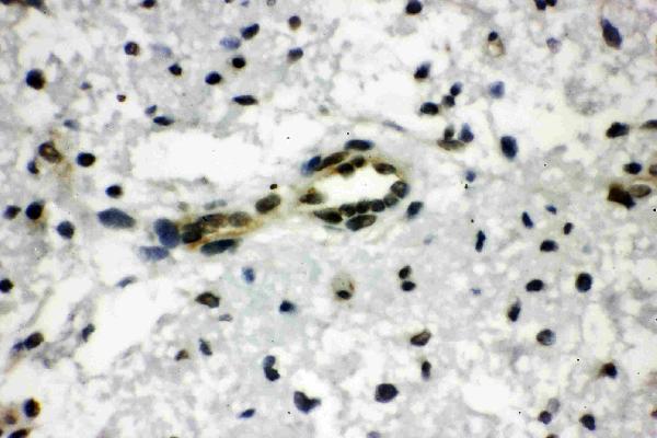 Anti-CtBP1 antibody, PA1570, IHC(P) IHC(P): Rat Brain Tissue