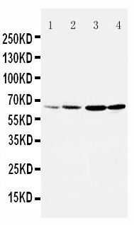 Anti-DRD1 antibody, PA1571, Western blotting Lane 1: Rat Testis Tissue Lysate Lane 2: Rat Brain Tissue Lysate Lane 3: U87 Cell Lysate Lane 4: HELA Cell Lysate