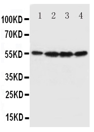 Anti-Fascin antibody, PA1575, Western blotting All lanes: Anti Fascin (PA1575) at 0.5ug/ml