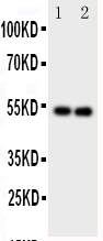 Anti-GABA A Receptor alpha 1 antibody, PA1578, Western blotting Lane 1: Rat Brain Tissue Lysate Lane 2: Rat Brain Tissue Lysate