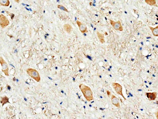 Anti-Dopamine Receptor D3 antibody, PA1584, IHC(P) IHC(P): Rat Brain Tissue