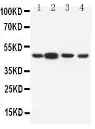 Anti-Dopamine Receptor D3 antibody, PA1584, Western blotting Lane 1: Rat Testis Tissue Lysate Lane 2: Rat Brain Tissue Lysate Lane 3: U87 Cell Lysate Lane 4: HELA Cell Lysate