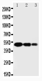 Anti-SPARC antibody, PA1585, Western blotting Lane 1: Recombinant Human SPARC Protein 10ng Lane 2: Recombinant Human SPARC Protein 5ng Lane 3: Recombinant Human SPARC Protein 2.5ng