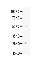 Anti-TREM1 antibody, PA1586, Western blotting Lane 1: Recombinant Mouse TREM1 Protein 1ng