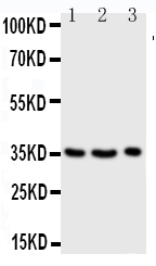 Anti-Granzyme A antibody, PA1588, Western blotting Lane 1: JURKAT Cell Lysate Lane 2: CEM Cell Lysate Lane 3: RAJI Cell Lysate