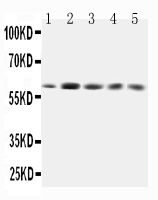 Anti-GRB7 antibody, PA1589-1, All Western blotting All lanes: Anti-GRB7(PA1589-1) at 0.5ug/ml