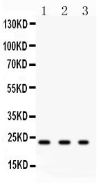 Anti-GST3/GST pi antibody, PA1590,Western blotting All lanes: Anti GST3/GST pi (PA1590) at 0.5ug/ml Lane 1: Rat Kidney Tissue Lysate at 50ug Lane 2: HELA Whole Cell Lysate at 40ug Lane 3: COLO320 Whole Cell Lysate at 40ug Predicted bind size: 23KD Observed bind size: 23KD