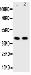 Anti-HDAC8 antibody, PA1591, Western blotting All lanes: Anti HDAC8 (PA1591) at 0.5ug/ml