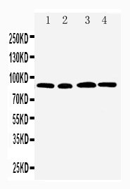 Anti-CD168 antibody, PA1592, Western blotting Lane 1: MM231 Cell Lysate Lane 2: MM453 Cell Lysate Lane 3: HELA Cell Lysate Lane 4: A549 Cell Lysate