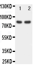 Anti-FOXP1 antibody, PA1593, Western blotting Lane 1: Rat Spleen Tissue Lysate Lane 2: COLO320 Cell Lysate