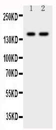 Anti-CD45 antibody, PA1596, Western blotting All lanes: Anti CD45 (PA1596) at 0.5ug/ml Lane 1: JURKAT Whole Cell Lysate at 40ug Lane 2: CEM Whole Cell Lysate at 40ug Predicted bind size: 147KD Observed bind size: 147KD