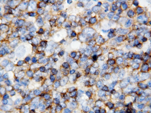 Anti-CD45 antibody, PA1596, IHC(P) IHC(P): Human Tonsil Tissue