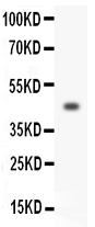 Anti-HOXA3 antibody, PA1602, Western blotting All lanes: Anti HOXA3 (PA1602) at 0.5ug/ml WB: SW620 Whole Cell Lysate at 40ug Predicted bind size: 46KD Observed bind size: 46KD