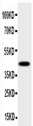 Anti-HSD17B2 antibody, PA1604, Western blotting All lanes: Anti HSD17B2 (PA1604) at 0.5ug/ml WB: Human Placenta Tissue Lysate at 50ug Predicted bind size: 43KD Observed bind size: 43KD