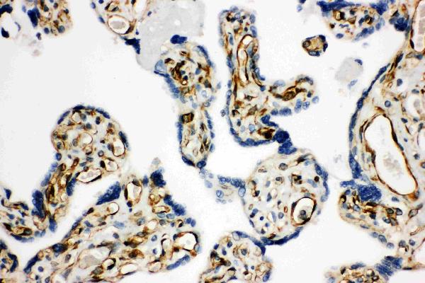 Anti-HSD17B2 antibody, PA1604, IHC(P) IHC(P): Human Placenta Tissue