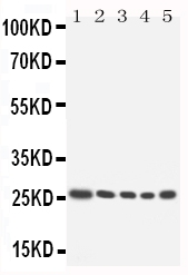 Anti-HOXA6 antibody, PA1605, Western blotting Lane 1: SW620 cell Lysate Lane 2: SW620 cell Lysate Lane 3: HELA cell Lysate Lane 4: HT1080 cell Lysate Lane 5: HT1080 cell Lysate