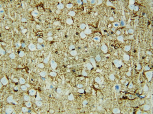 Anti-HSF2 antibody, PA1607, IHC(P) IHC(P): Rat Brain Tissue