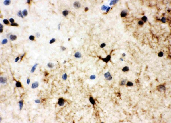 Anti-HSF2 antibody, PA1607, IHC(P) IHC(P): Rat Brain Tissue