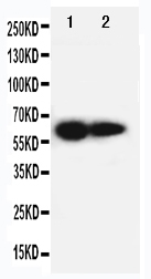 Anti-IL2RB antibody, PA1615, Western blotting Lane 1: PANC Cell Lysate Lane 2: HELA Cell Lysate