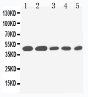 Anti-IL2 Receptor gamma antibody, PA1616, Western blotting Lane 1: PANC Cell Lysate Lane 2: HELA Cell Lysate Lane 3: JURKAT Cell Lysate Lane 4: RAJI Cell Lysate Lane 5: CEM Cell Lysate