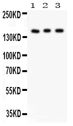 Anti-Insulin Receptor antibody, PA1620, Western blotting All lanes: Anti Insulin Receptor(PA1620) at 0.5ug/ml Lane 1: Rat Kidney Tissue Lysate at 50ug Lane 2: PANC Whole Cell Lysate at 40ug Lane 3: HELA Whole Cell Lysate at 40ug Predicted bind size: 155KD Observed bind size: 155KD