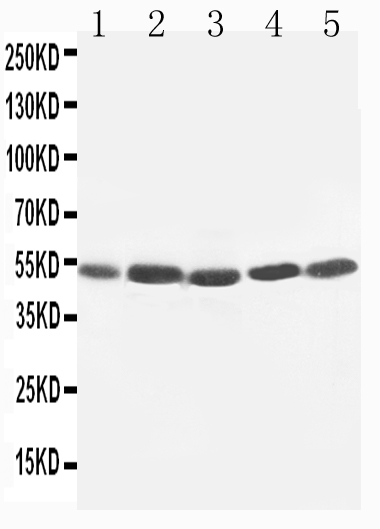 Anti-TIM 1 antibody, PA1624, Western blotting Lane 1: SMMC Cell Lysate Lane 2: HELA Cell Lysate Lane 3: PANC Cell Lysate Lane 4: M231 Cell Lysate Lane 5: M453 Cell Lysate