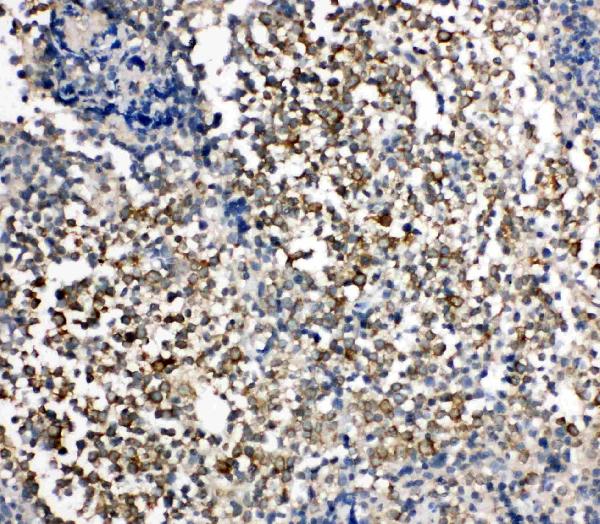 Anti-TIM 1 antibody, PA1624, IHC(P) IHC(P): Human Tonsil Tissue