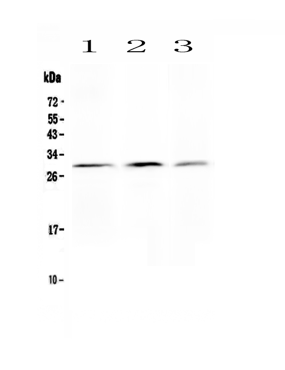 Western blot analysis of Kallikrein 2 using anti-Kallikrein 2 antibody (PA1626).