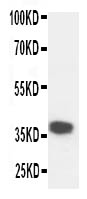 Anti-Kallikrein 5 antibody, PA1630, Western blotting WB: Mouse Liver Tissue Lysate