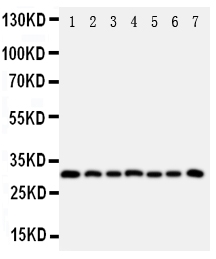 Anti-Kallikrein 11 antibody, PA1631, Western blotting All lanes: Anti Kallikrein 11 (PA1631) at 0.5ug/ml