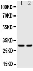 Western blot analysis of Kallikrein 1 using anti-Kallikrein 1 antibody (PA1633).