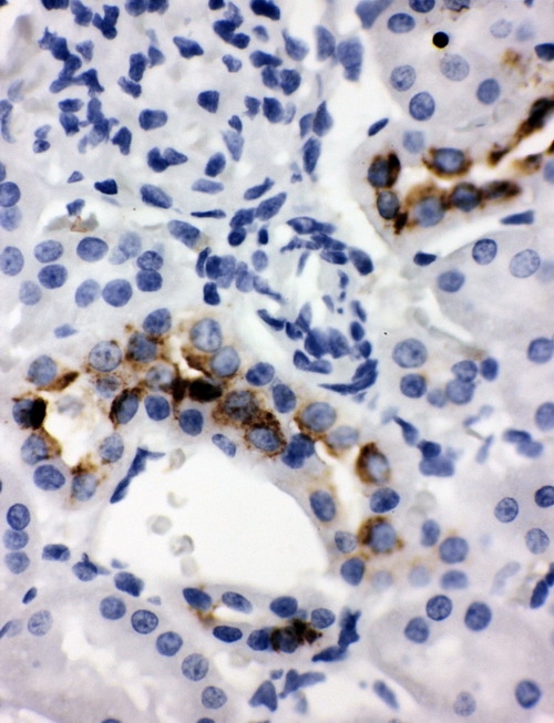 IHC analysis of Kallikrein 1 using anti-Kallikrein 1 antibody (PA1633). Kallikrein 1 was detected in a paraffin-embedded section of rat kidney tissue. Heat mediated antigen retrieval was performed in EDTA buffer (pH 8.0, epitope retrieval solution). The tissue section was blocked with 10% goat serum. The tissue section was then incubated with 1 μg/ml rabbit anti-Kallikrein 1 Antibody (PA1633) overnight at 4°C. Biotinylated goat anti-rabbit IgG was used as secondary antibody and incubated for 30 minutes at 37°C. The tissue section was developed using Strepavidin-Biotin-Complex (SABC) (Catalog # SA1022) with DAB as the chromogen.