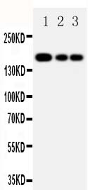 Anti-MRP1 antibody, PA1634, Western blotting Lane 1: JURKAT Cell Lysate Lane 2: CEM Cell Lysate Lane 3: A549 Cell Lysate